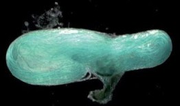 巨大精子在线观看,揭秘巨大精子在线观看之旅